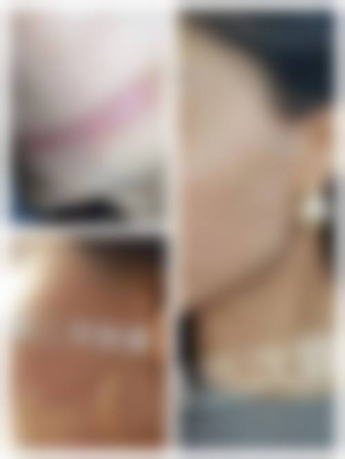 预约优惠活动北京邦妍医疗美容门诊部甘春柳