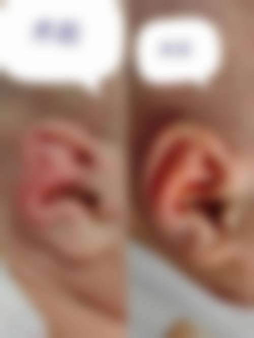 擅长项目详解:康虹医生擅长做我需要的项目吗?