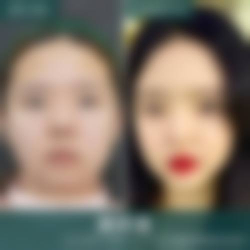 患者真实评价