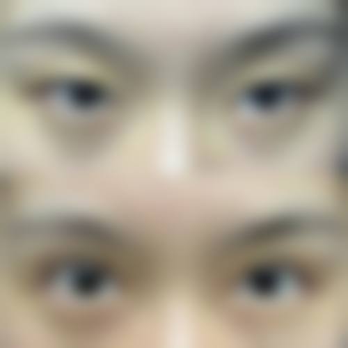 预约优惠活动：南方医 科 大学第五附属医院眼科罗平专属补贴