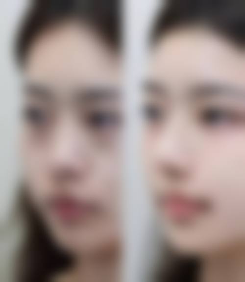热门项目价格参考一览