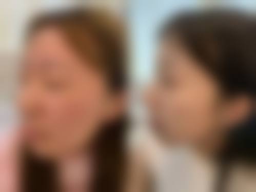 擅长项目详解:袁朝英医生擅长做我需要的项目吗
