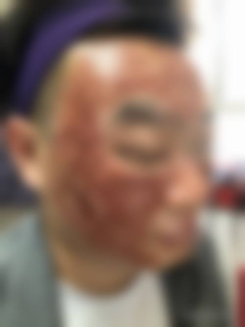 医生资质介绍:袁朝英医生靠谱吗