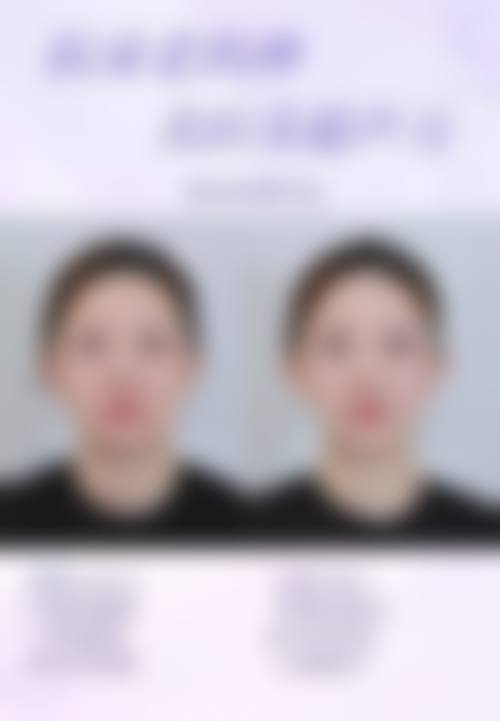 FAQ:常见疑问解答