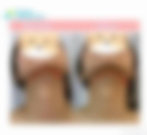 结尾预约号召:立即行动变得更美