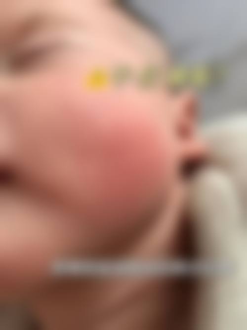 擅长项目详解：顾敏医生擅长的项目适合我吗？