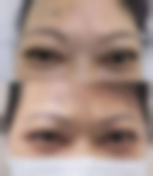 结尾预约号召:立即行动,重获清晰视界