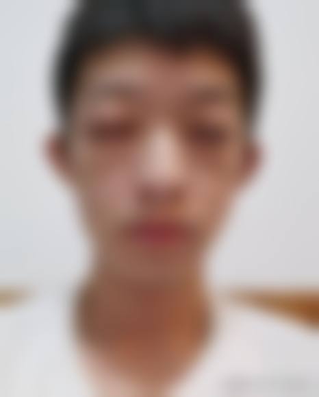 临床实例分享:真实反馈与疗效见证