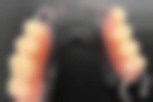 擅长项目详解:隐形与传统矫正双优