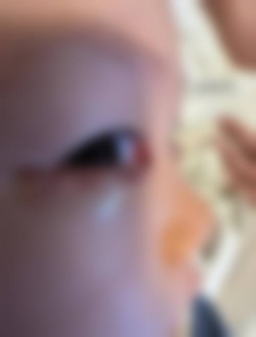 擅长项目详解:哈尔滨焦视眼科医院张蔓的技术特长