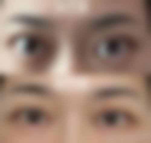 精细医疗设备与特色眼科整形项目推荐