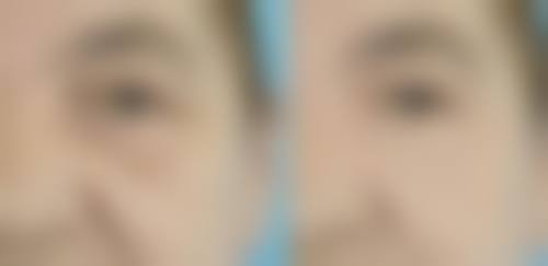 透明价格体系与惠民优惠活动