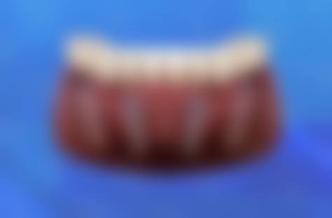 优惠活动详情