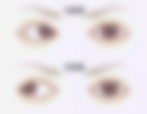 医生资质介绍:哈尔滨焦视眼科医院刘昭英