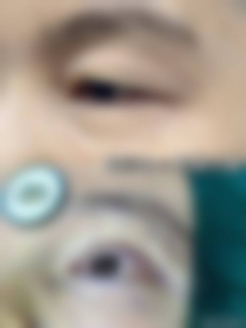 擅长项目详解:哈尔滨焦视眼科医院刘昭英
