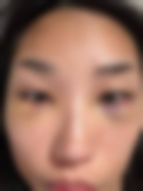 核心整形项目与技术优势