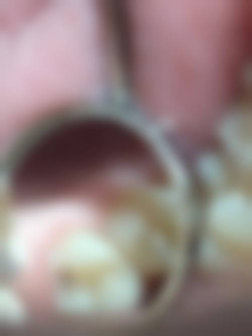 预约优惠活动:现在去有优惠吗?