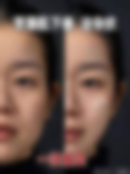 FAQ唯宁医生