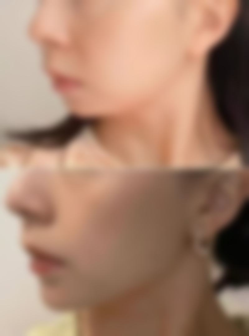 热门项目市场价格与服务流程详解