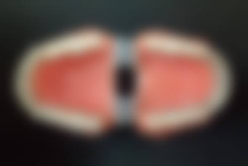 患者真实评价深圳明森数智口腔门诊部李文雯医生