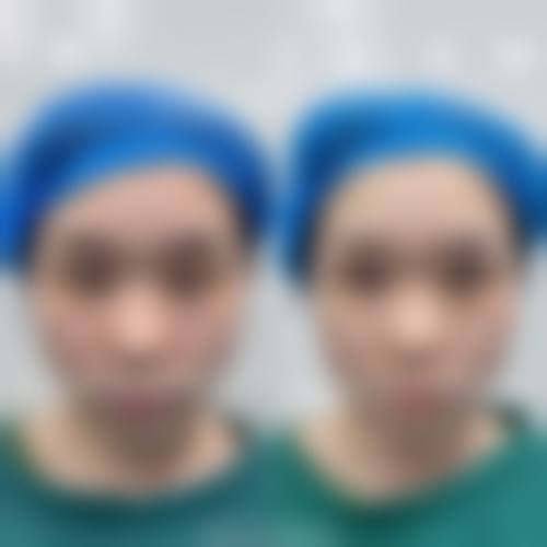 预约优惠活动